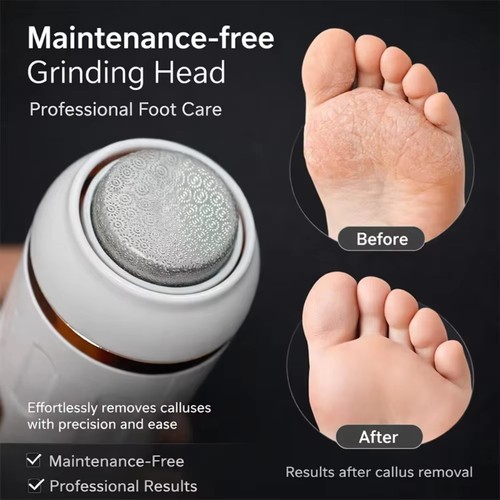 Rechargeable electric feet - electric,