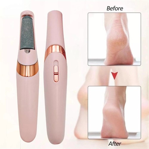Feet callus remover - callus,